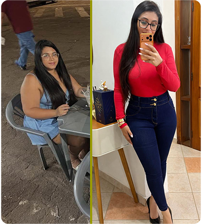 Antes e depois
